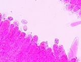 Melanoleuca evenosa image