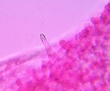 Melanoleuca evenosa image