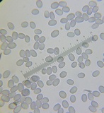 Amanita morrisii image