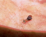 Dacryopinax elegans image