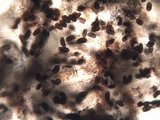 Buellia subdisciformis image