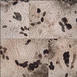 Buellia subdisciformis image