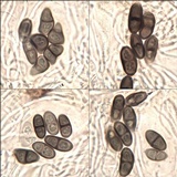 Buellia subdisciformis image