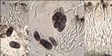 Buellia saxorum image
