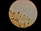 Agaricus bitorquis image