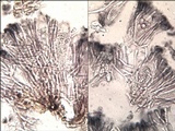 Tephromela atra var. atra image