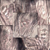 Tephromela atra var. atra image