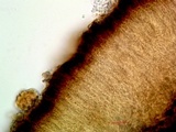 Trapeliopsis glaucopholis image