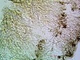 Trapeliopsis glaucopholis image