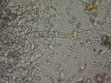 Hyphoderma setigerum image