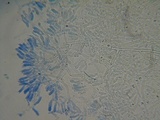 Athelia bombacina image