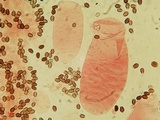 Coprinellus saccharinus image