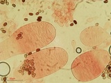 Coprinellus saccharinus image