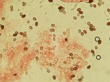 Coprinellus saccharinus image