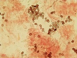 Coprinellus saccharinus image