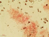 Coprinellus saccharinus image