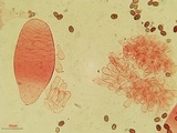 Coprinellus saccharinus image