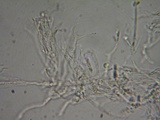 Dacrymyces punctiformis image