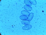 Scutellinia nigrohirtula image