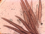 Scutellinia nigrohirtula image