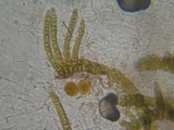 Pezoloma ciliifera image