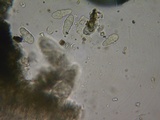 Hysterobrevium smilacis image
