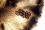 Diplotomma alboatrum image