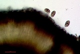 Diplotomma alboatrum image