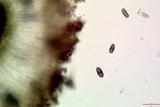Amandinea punctata image