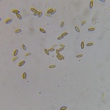 Boletus subfraternus image
