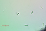 Alyxoria ochrocheila image