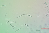 Alyxoria ochrocheila image