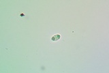 Caloplaca flavorubescens image