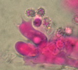 Trechispora hymenocystis image