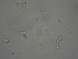 Dacrymyces capitatus image