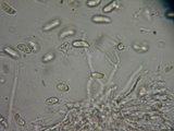Dacrymyces capitatus image