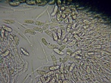 Dacrymyces capitatus image