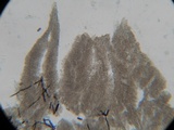 Hyphodontia quercina image
