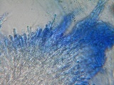 Hyphodontia quercina image