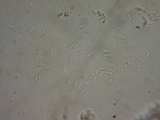 Hyphodontia quercina image