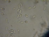 Hyphodontia quercina image
