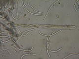 Stictis ostropoides image