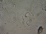 Stictis ostropoides image