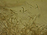 Stictis ostropoides image