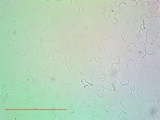 Lecanora confusa image