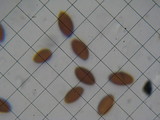 Coprinellus plagioporus image
