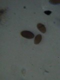 Coprinellus plagioporus image