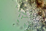 Lecania fuscella image