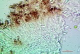 Lecania fuscella image