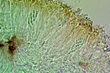 Lecania fuscella image